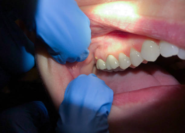 Reliable TX Emergency Dental Service Solutions